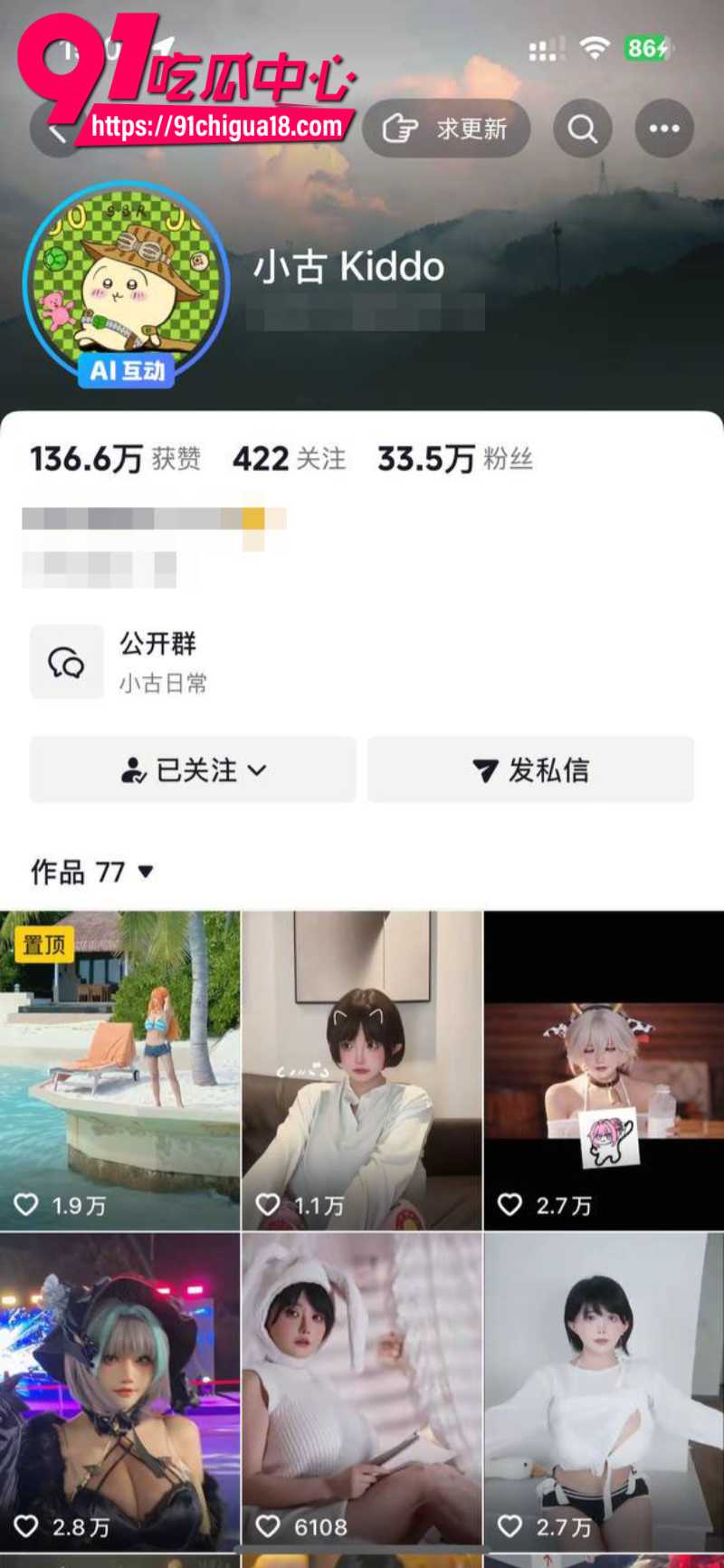 抖音极品女网红古阿扎 抖奶舞定制福利 胸前白嫩车灯闪瞎双眼