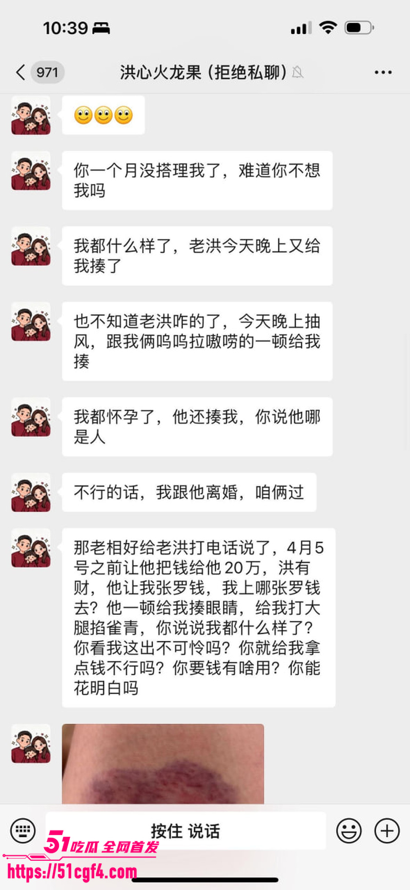 吉林 王星星 偷吃兄弟妻 火龙果 1 吉林 王星星 偷吃兄弟妻 火龙果 1