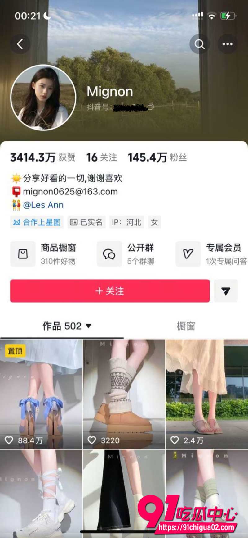 抖音145W粉丝网红Mignon1 抖音145W粉丝网红Mignon1