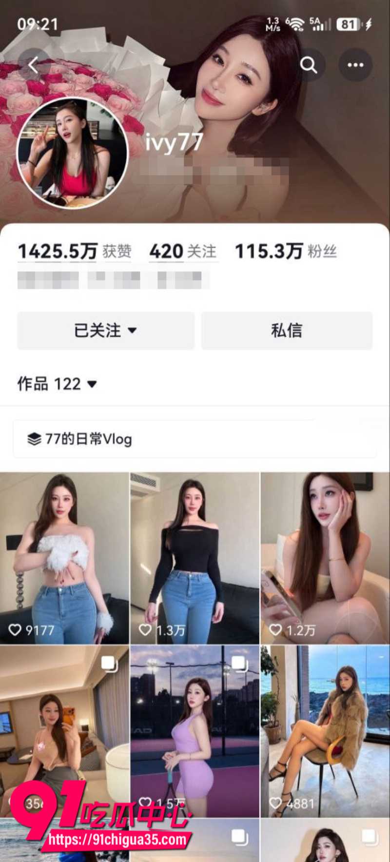 抖音115W粉丝女网红ivy77 高质量付费福利 性感娇躯堪称极品炮架