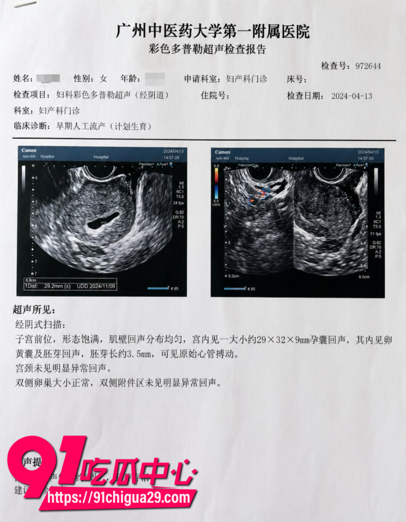 抖音700W粉丝女网红贵阳二小姐知三当三勾引杰少偷情被庄楚华实名举报24