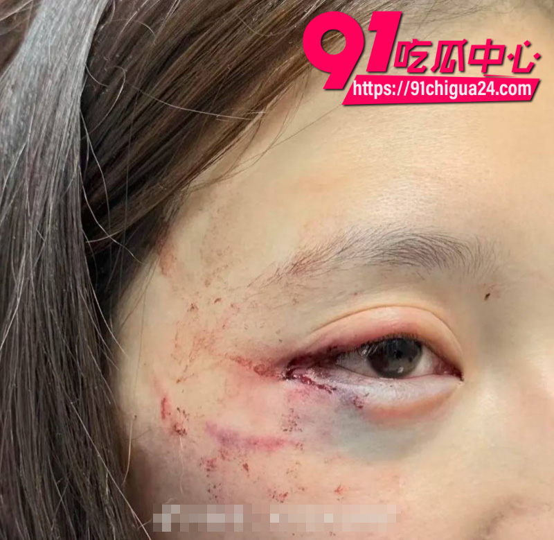千万大V张百乔家暴老婆视频流出老婆迅速网上辟谣28