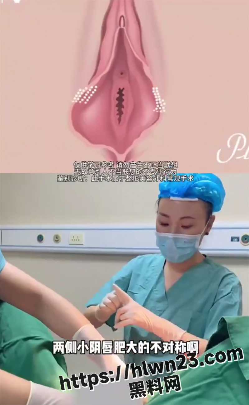 女性医学科普 阴唇肥大阴蒂包皮过长的处理方法 女生朋友们可要拿小本子记好了!